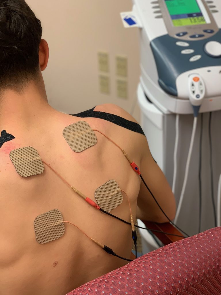 Electrical Stimulation